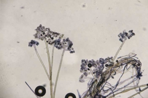 La moisissure grise formée par <i><b>Botrytis cinerea</i></b> est en fait constituée par de très nombreux conidiophores ramifiés, portant des conidies ovoïdes et hyalines à l'extrémité de stérigmates.