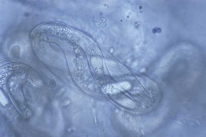 Dans chaque oeuf libéré, se développe une larve, qui infestera une nouvelle racine. <i><b>Globodera tabacum</b></i> ("cyst nematodes")