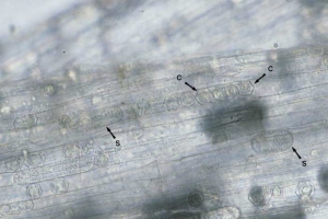 Sporanges (S) et chlamydospores (spores de repos, resting spores) (C) d' <b><i>Olpidium brassicae </i></b>remplissant certaines cellules racinaires.