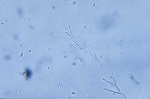 Les conidiophores de <b><i>Verticillium dahliae</i></b> ("verticillium wilt") sont ramifiés d'une façon verticillée ; ils produisent des conidies unicellulaires, ovoïdes et hyalines.