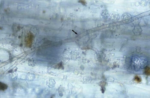 Le mycélium brun et ramifié de <b><i>Rhizoctonia solani </i></b>est aisément visible sur ce système racinaire. 