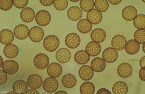 uredospore_puccinia