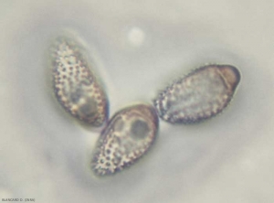 tranzschelia_uredospores