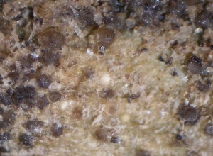 Plusieurs pycnides globuleuses plus ou moins matures parsèment les tissus. <b><i>Didymella lycopercisi</i></b> (taches à <i>Didymella</i>, <i>Didymella</i> leaf spot)