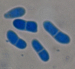 Détail de pycniospores  uni ou bicellulaires. <b><i>Didymella lycopersici</i></b> (chancre à <i>Didymella</i>, <i>Didymella</i> stem canker and fruit rot)
