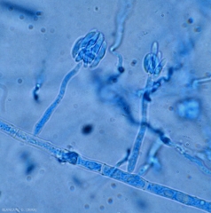 Jeunes conidiophores de <b><i>Fusarium oxysporum</i> f. sp. <i>lycopersici</i> </b> formant de jeunes microconidies pluricellulaires. <b>Fusariose vasculaire (<i>Fusarium</i> wilt)</b>