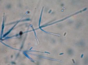 Verticillium14