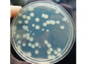 Colonies de bactéries <i><b>Bacillus thuringiensis</i> kurstaki (Btk)</b>, dans une boîte de Pétri