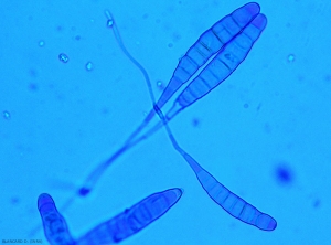 Spores  en forme de massue assurant la dissémination de l'alternariose sur tomate (aspect au microscope). Elles se forment sur les différentes lésions présentes sur les folioles, les tiges et les fruits.