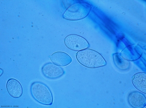 Aspect au microscope des spores ou  sporanges de mildiou. <b><i>Phytophthora infestans</i></b> (mildiou)