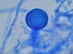 Aspect au microscope d'une future oospore de mildiou de la pomme de terre. <b><i>Phytophthora infestans</i></b> 