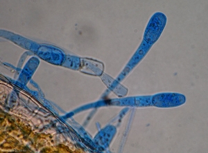 Détail de la formation de spores d'oïdium vu au microscope.