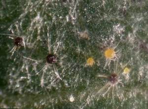 Aspect des cléistothèces d'oïdium de la vigne à la loupe binoculaire. Les plus murs sont de couleur brun foncé.