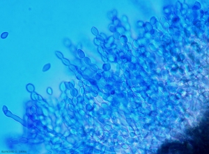 Aspect microscopique de la formation en chaînes des spores de <i>Monilia laxa</i> (moniliose)