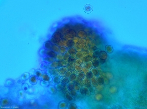 Aspect microscopique d'un jeune sore de rouille formant des spores (urédospores) sur feuille de poireau.