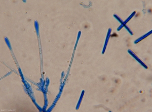 Aspect des structures permettant à <i>Cylindrocladium buxi</i> de former des spores allongées sur les tissus du buis altérés .
