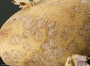 Tâches gris argenté sur tubercules de pomme de terre provoquées par le champignon agent de la gale argentée. <i><b>Helminthosporium solani</i></b>