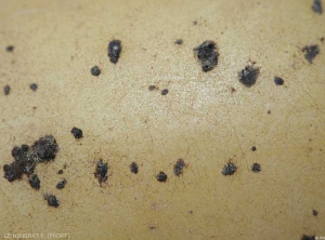 Gros plan de sclérotes de <i><b>Rhizoctonia solani</i></b> (rhizoctone brun) avec présence de mycélium de couleur marron du champignon.