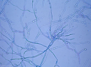 Mycelium-Phytophthora1