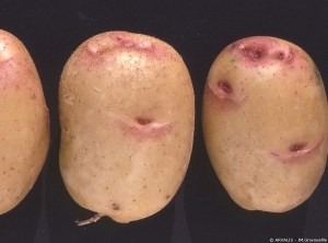 Pigmentation anthocyanique de la peau au niveau des yeux de tubercules de pomme de terre liée à un caractère variétal