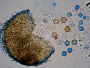 Ce périthèce a été pressé afin de libérer des asques contenant une ascospore plus ou moins mature, certaines encore hyalines, d'autres légèrement brunes. <i><b>Monosporascus </i>sp.</b>