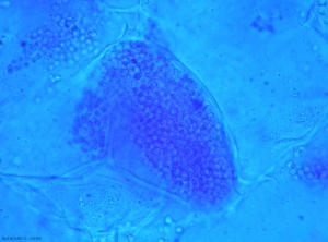 Plasmodiophora1