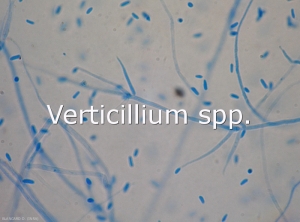 Verticillium-Conidies