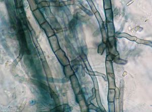 Phomopsis-sclerotioides-Mycelium
