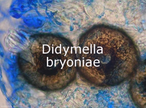 Didymella-btyoniae-Peritheces
