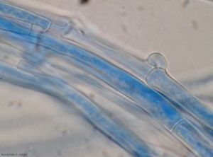 Sclerotium-rolfsii8