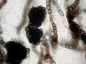 Détail au microscope photonique des <b>microsclérotes</b> formés par  <i><b>Verticillium dahliae</b></i>. <b> (Verticilliose)