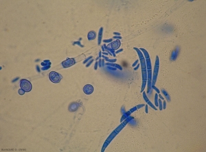 Micro, macroconidies et chlamydospores de  <i>Fusarium</i> sp. 