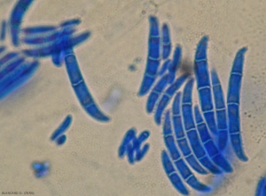 Fusarium-oxysporum4