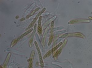 Vues au microscope optique d'asques et d'ascospores de <i>Venturia inaequalis</i> (Photo M.-N. Bellanger, INRA)