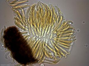 Pseudothèce mature de <i>Venturia inaequalis</i> montrant des asques et des ascospores au microscope optique (photo F. Didelot, INRA)