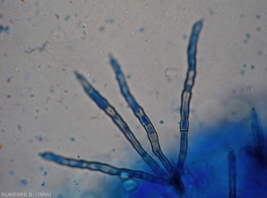 Les conidiophores de <i>Cercospora abelmoschi</i> ont une teinte pâle à brun olivâtre,  (cercosporiose)