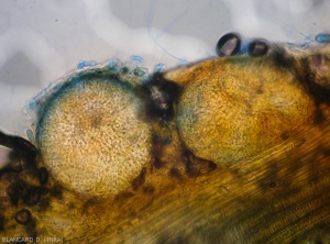 Aspect de fructification de <i>Didymella bryoniae</i> en cours de formation dans des tissus affétés. (forme téléomorphe)(pourriture noire, black rot)