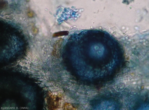 Aspect d'une pycnide mature : des conidies sont présentes à proximité de l'ostiole.  <b><i>Phoma cucurbitacearum</i></b> (forme anamorphe)(pourriture noire, black rot)