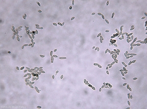 Spores de <i>Cladosporium</i> spp. au microscope (photo M. Giraud, CTIFL)