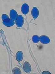Détail d'un sporangiophore arbusculeux de mildiou observé au microscope photonique. Notez les sporanges formés aux extrémités. (<i>Pseudoperonospora cubensis</i>) (mildiou)