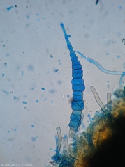 Détail d'une conidie d'<i>Alternaria brassicicae</i>. Notez qu'elle est plutôt élancée et qu'elle possède  un appendice plus long. (alternariose du chou)