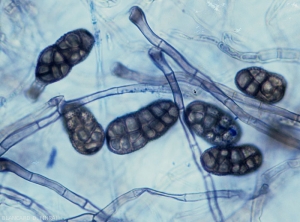 <i><b>Stemphylium vesicarium</b></i> présente des conidies aux extrémités arrondies, à la paroi échinulée, présentant de 2 à 4 constrictions. Elles ont également une teinte brune, une forme rectangulaire et mesurent 26-44 x 12-20 µm. La forme parfaite du champignon, <i>Pleospora allii</i> se forme sur milieu artificiel in vitro. (Stemphyliose _ grey leaf spot)
