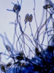 Conidiophores portant des conidies isolées de <b><i>Stemphylium solani</i></b>. (Stemphyliose - grey leaf spot)