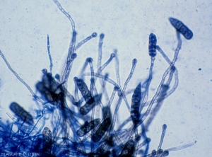 Conidiophores à l'extrémité desquels se sont formées des conidies cloisonnées de <i><b>Stemphylium floridanum</b></i>.(Stemphyliose - grey leaf spot)