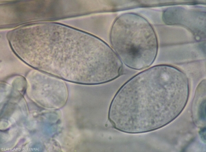 Variabilité morphologique  des sporanges de <b><i>Phytophthora infestans</i></b> observés au microscope photonique. (mildiou)