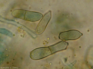 Détail des conidies bicellulaires les plus caractéristiques de la forme asexuée de <b><i>Passalora fulva</i></b> (cladosporiose, leaf mold) 