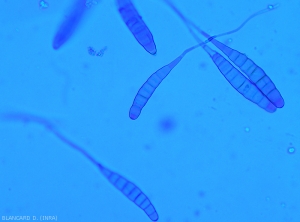 Aspect de conidies d'<b><i>Alternaria tomatophila</i></b> observées au microscope photonique. Les spores de ce champignon, pluricellulaires et allongées, sont solitaires et pourvues d'un prolongement hyalin filiforme. <b>Alternariose (early blight)</b>