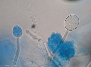 Formation d'un jeune sporange, notez les renflements parfois présents sur les sporangiophores. <b><i>Phytophthora infestans</i></b> (mildiou)