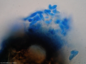 Des conidies ont été extrudées par l'ostiole, certaines sont bicellulaires et caractéristiques.  <b><i>Phoma cucurbitacearum</i></b> (forme anamorphe)(pourriture noire, black rot)