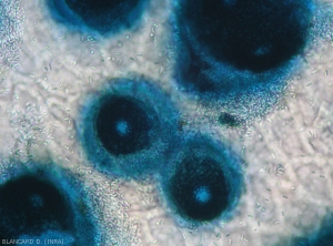 Aspect au microscope photonique de plusieurs pycnides de <b><i>Phomopsis vexans</i></b> formées sur des tissus altérés. Remarquez une ostiole présente sur chacune d'entre-elles et de nombreuses spores alpha.